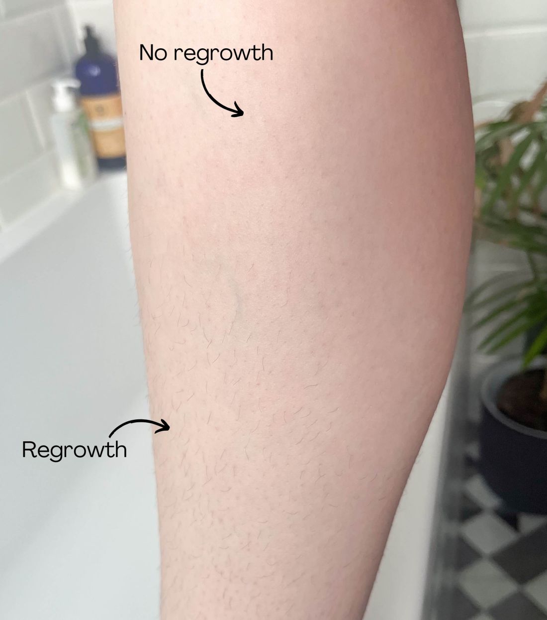 Results from using CurrentBody Laser Hair Removal Device